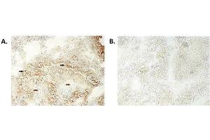 Immunohistochemical staining of bioptic sections of small intestine using anti-NLRP6/NALP6 (human), mAb (Clint-1)  at 1:500 dilution.