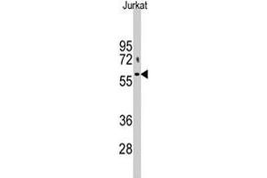 Western blot analysis of PFKFB1 polyclonal antibody  in Jurkat cell lysate (35 ug/lane). (PFKFB1 antibody  (N-Term))