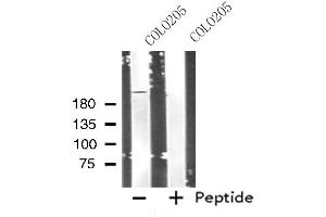 Western blot analysis of extracts from COLO205 cells, using LY75 antibody. (LY75/DEC-205 antibody  (Internal Region))