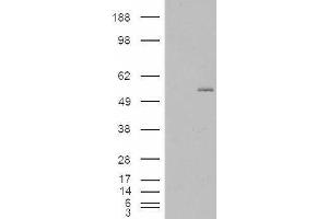 HEK293 overexpressing GCNT3 (ABIN5434272) and probed with ABIN238636 (mock transfection in first lane). (GCNT3 antibody  (Internal Region))