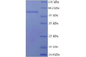 SDS-PAGE (SDS) image for Myeloproliferative Leukemia Virus Oncogene (MPL) (AA 26-491), (Extracellular) protein (His tag) (ABIN5709953)