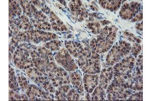 Image no. 3 for anti-Diphthamide Biosynthesis Protein 2 (DPH2) antibody (ABIN1497893) (DPH2 antibody)