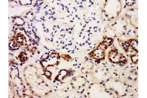 Formalin-fixed and paraffin embedded human kidney labeled with Anti-PBEF (CT) Polyclonal Antibody, Unconjugated  at 1:300 followed by conjugation to the secondary antibody and DAB staining. (NAMPT antibody  (AA 401-491))