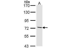 WB Image Sample (30 ug of whole cell lysate) A: Hela 7. (DYNC1I2 antibody)