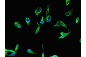 Immunofluorescent analysis of Hela cells using ABIN7145318 at dilution of 1:100 and Alexa Fluor 488-congugated AffiniPure Goat Anti-Rabbit IgG(H+L) (BCL2A1 antibody  (AA 1-175))