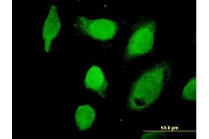 Immunofluorescence of purified MaxPab antibody to CAPN1 on HeLa cell.