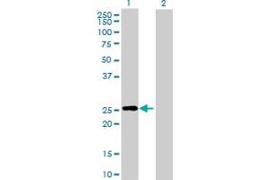 Western Blot analysis of RND3 expression in transfected 293T cell line by RND3 MaxPab polyclonal antibody. (RND3 antibody  (AA 1-244))