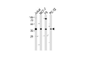 Western blot analysis of lysates from Jurkat, MCF-7, F9, PC-12 cell line (from left to right), using human-FOSL2 (Y83) (ABIN6243663 and ABIN6577541). (FOSL2 antibody  (AA 70-110))