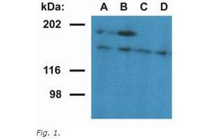 Western Blotting (WB) image for anti-Ubinuclein 1 (UBN1) (AA 1-190), (N-Term) antibody (ABIN614815) (Ubinuclein 1 antibody  (N-Term))