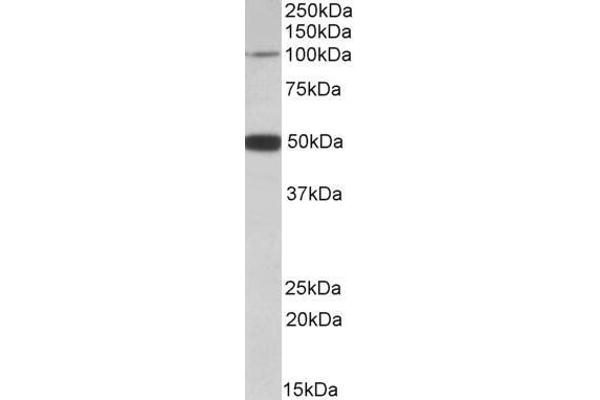 PTCHD1 anticorps  (Internal Region)