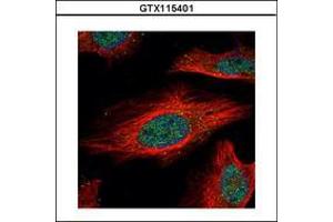 Image no. 3 for anti-Interferon Regulatory Factor 9 (IRF9) (AA 171-393) antibody (ABIN1498905) (IRF9 antibody  (AA 171-393))