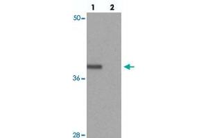 Western blot analysis of PRICKLE4 in A-549 cell lysate with PRICKLE4 polyclonal antibody  at 0.