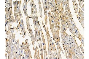 ABIN7094099 and ABIN7098143 at 1/100 staining mouse heart tissue by IHC-P.