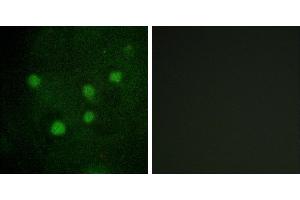 Peptide - +Western blot analysis of extracts from LOVO cells, using BAF250B antibody. (ARID1B antibody)