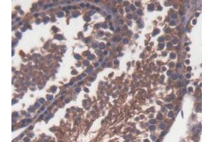DAB staining on IHC-P; Samples: Mouse Testis Tissue (TLR1 antibody  (AA 25-134))