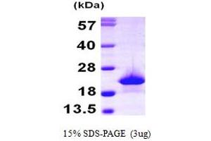 SDS-PAGE (SDS) image for MB (AA 1-154) protein (His tag) (ABIN667863) (MB Protein (AA 1-154) (His tag))