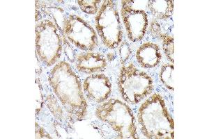 Immunohistochemistry (IHC) image for anti-BCL2/adenovirus E1B 19kDa Interacting Protein 3-Like (BNIP3L) (AA 1-187) antibody (ABIN6137622)