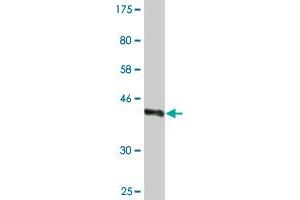 Western Blot detection against Immunogen (37. (WWP1 antibody  (AA 152-260))