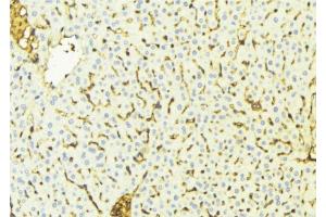 ABIN6269022 at 1/100 staining Mouse liver tissue by IHC-P. (VDAC1 antibody  (C-Term))