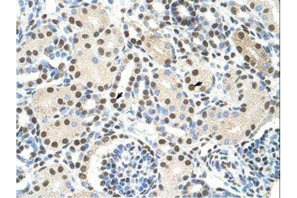 AKAP8L antibody  (C-Term)