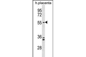 PD5 Antibody (N-term) (ABIN1538868 and ABIN2849912) western blot analysis in human placenta tissue lysates (35 μg/lane). (PAPD5 antibody  (N-Term))