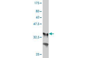 Western Blot detection against Immunogen (36. (GRB10 antibody  (AA 61-150))