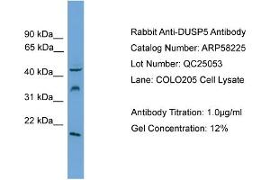 WB Suggested Anti-DUSP5  Antibody Titration: 0. (DUSP5 antibody  (Middle Region))