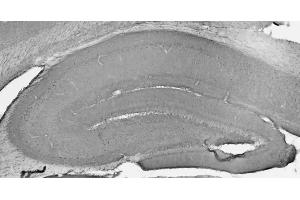 Adult rat hippocampus immunohistochemistry.