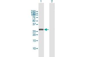 Western Blot analysis of DUT expression in transfected 293T cell line by DUT MaxPab polyclonal antibody. (Deoxyuridine Triphosphatase (DUT) (AA 1-252) antibody)