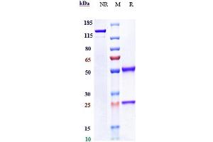 Anti-DDR1 / CD167a Reference Antibody (Imperial College anti-DDR1) on SDS-PAGE under reducing (R) condition.