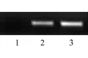 Dot Blot (DB) image for anti-Histone H2B (acLys5) antibody (ABIN2668338)
