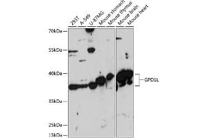 Western blot analysis of extracts of various cell lines, using GPD1L antibody (ABIN7267460) at 1:3000 dilution. (GPD1L antibody  (AA 1-351))