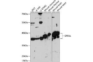 Western blot analysis of extracts of various cell lines, using GPD1L antibody (ABIN7267460) at 1:3000 dilution.