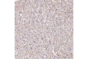 Immunohistochemical staining of human liver with TCHP polyclonal antibody  shows distinct membranous positivity in hepatocytes at 1:1000-1:2500 dilution.