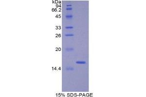 SDS-PAGE (SDS) image for Angiogenin (ANG) (AA 25 -145) protein (His tag) (ABIN2120569)