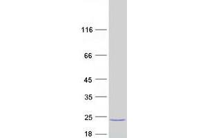 Validation with Western Blot (MARCH2 Protein (Transcript Variant 2) (Myc-DYKDDDDK Tag))