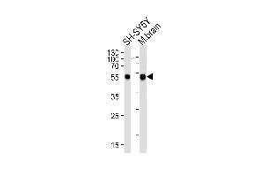 Western blot analysis of lysates from SH-SY5Y cell line and mouse brain tissue lysates (from left to right), using DK2 Antibody (M1) 7033a. (DAPK2 antibody  (N-Term))