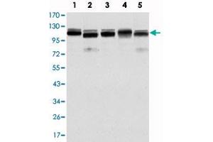 Western blot analysis using BMPR2 monoclonal antibody, clone 3F6  against HeLa (1) , A-431 (2) , NIH/3T3 (3) , COS-7 (4) and PC-12 (5) cell lysate.