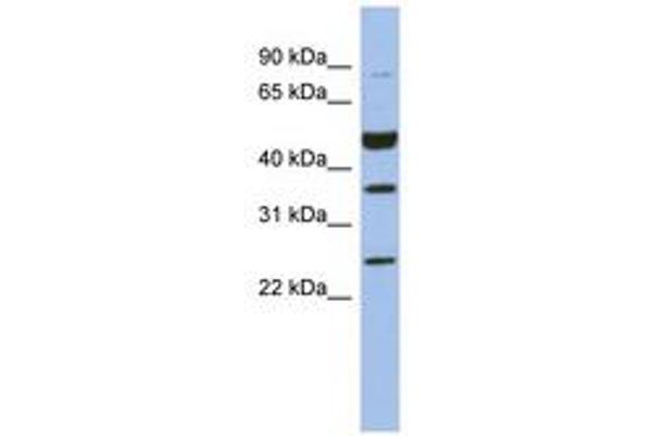 MAGEB3 antibody  (AA 35-84)