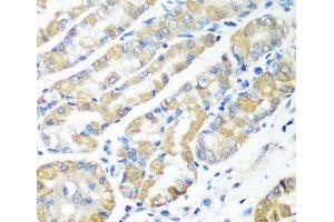 Immunohistochemistry of paraffin-embedded Human stomach using MSRB2 Polyclonal Antibody at dilution of 1:100 (40x lens). (MSRB2 antibody)