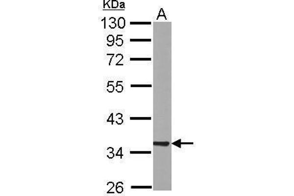 RABGGTB antibody