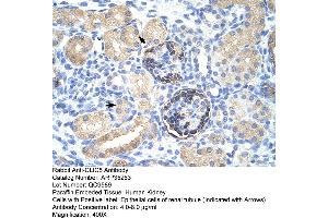 Human kidney (CLIC5 antibody  (C-Term))