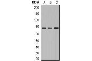 Western blot analysis of Beta-galactosidase expression in Hela (A), A549 (B), NIH3T3 (C) whole cell lysates. (GLB1 antibody)