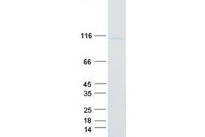 Validation with Western Blot