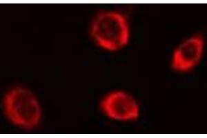 ABIN6279649 staining Hela cells by IF/ICC. (PEX5 antibody  (Internal Region))