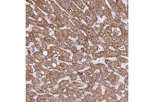 Immunohistochemical staining of human liver with LOC728597 polyclonal antibody ( Cat # PAB28327 ) shows strong cytoplasmic positivity in hepatocytes at 1:200 - 1:500 dilution.
