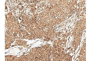 Immunohistochemistry analysis using Rabbit Anti-FUNDC1 Polyclonal Antibody (ABIN5066123). (FUNDC1 antibody  (N-Term) (Atto 594))