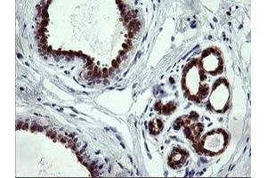 Image no. 2 for anti-Cytidine Monophosphate (UMP-CMP) Kinase 1, Cytosolic (CMPK1) antibody (ABIN1497544) (Cytidine Monophosphate (UMP-CMP) Kinase 1, Cytosolic (CMPK1) antibody)