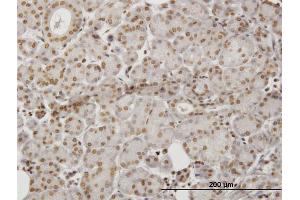 Immunoperoxidase of monoclonal antibody to HIPK1 on formalin-fixed paraffin-embedded human salivary gland.
