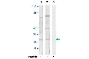 Western blot analysis of extracts from HUVEC cells (Lane 1 and lane 3) and COLO 205 cells (Lane 2), using SIX6 polyclonal antibody . (SIX Homeobox 6 antibody)